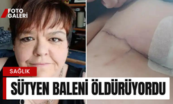 Sütyen balenindeki metalden et yiyen bakteri kaptı!