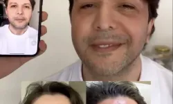 Nihat Doğan estetik işlem yaptırdı