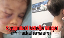 2 yaşındaki bebeğe vahşet: Hayati tehlikesi devam ediyor