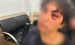 “Kurtuluş Yok Tek Başına” şarkısını söyleyen 15 yaşındaki çocuğa yumruklu saldırı