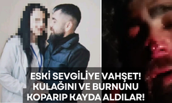 Kulağını ve Burnunu Koparıp Kayda Aldılar!