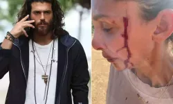 Can Yaman’ın Sevgilisi Sara Bluma Şiddeti Anlattı! “Oğlumla Görüşmem Engelleniyor”