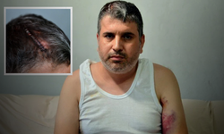 Kadına Miras Vermek İstemedi, Yeğenini Dövdü
