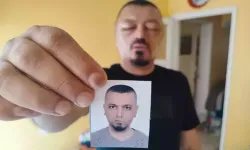 Berberin Tavsiyesi Hayatını Kararttı! İnternetten Aldığı Şampuanla Hastanelik Oldu