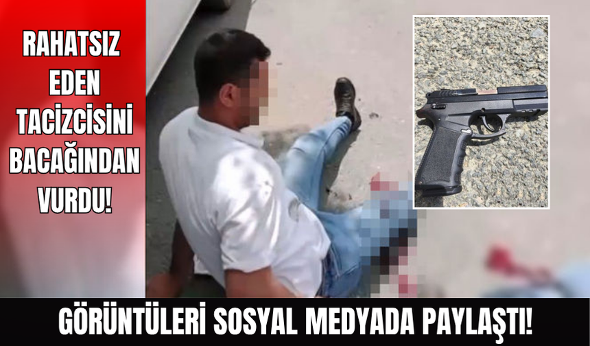 Tacizcisini bacağından vurdu, kaydetti!