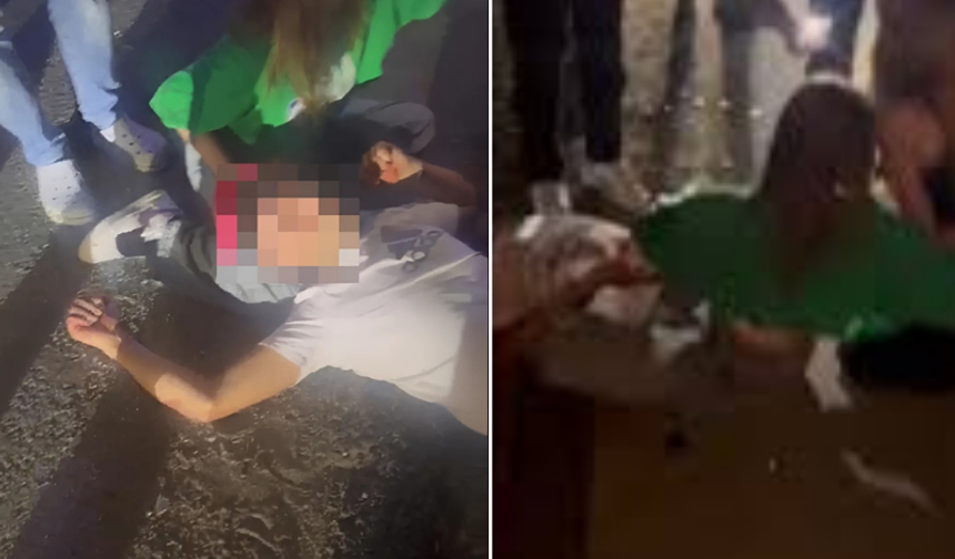 Yaralı arkadaşını dizine yatırıp, başından ayrılmadı!