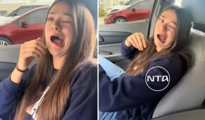 Diş tedavisinden sonra yüz felci mi geçirdi? Genç kadının panik anı kamerada!