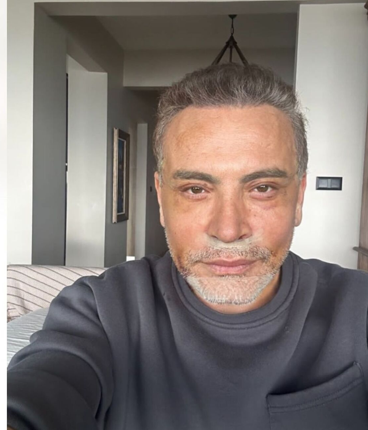 Cenk Eren'in ameliyat ücreti herkesi şok etti!