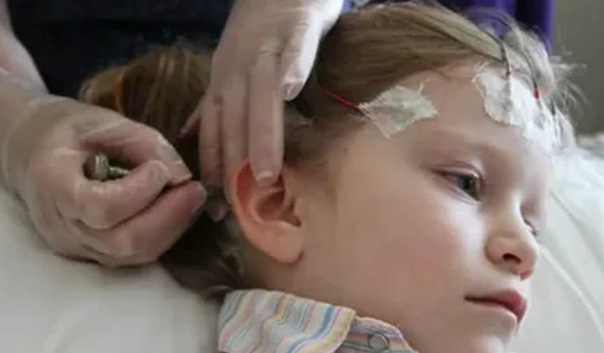 epilepsi tetikleyici faktörler olmadan ortaya çıkıyor