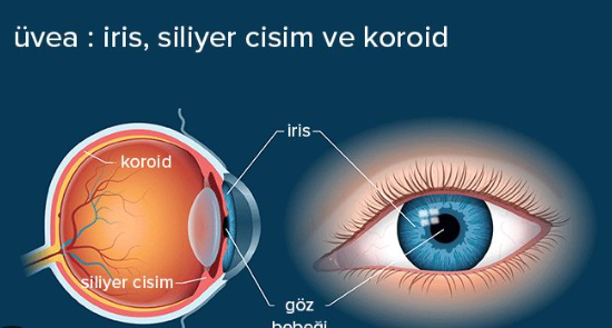 Üveit nedir? Nasıl tedavi edilir?