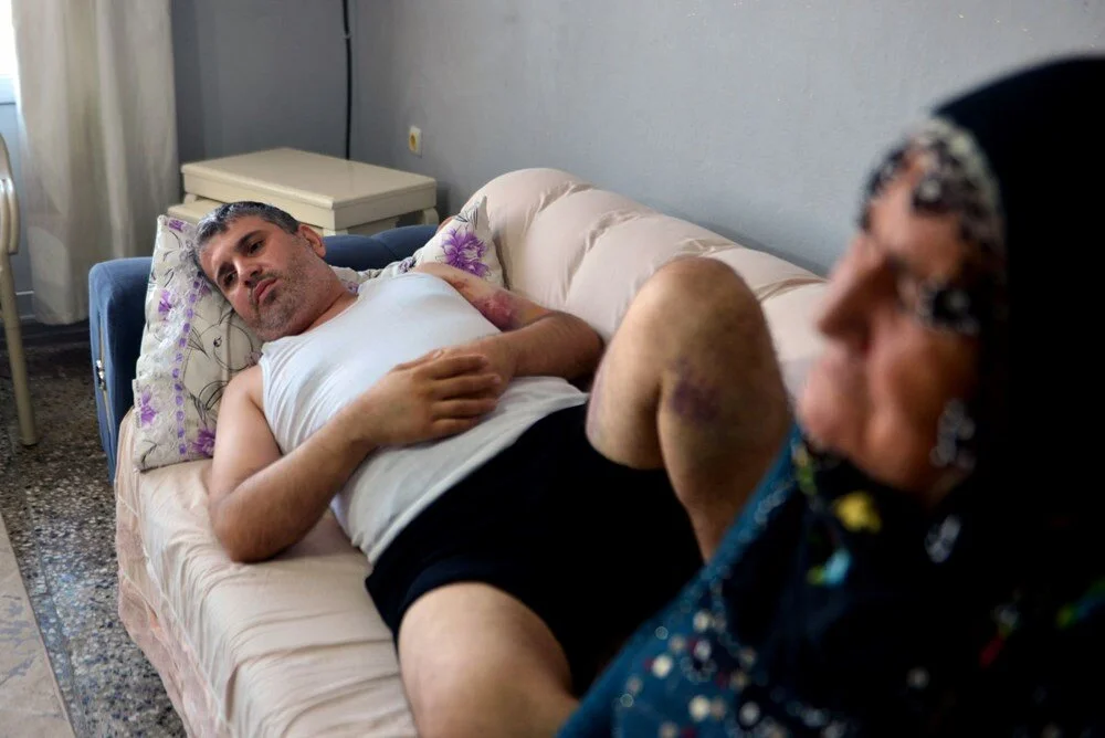 Miras Kavgası 1