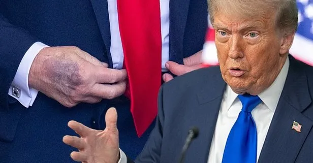 Trump 1-2