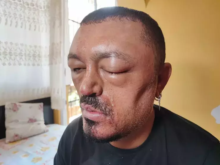 Berberi Tavsiye Etti 1
